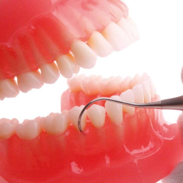 ZFMBL1F-Zahnreiniger-Feile-BL1-Bukkal-Lingual-diamantiert-D-54-leicht-ergonomische-Anwendung