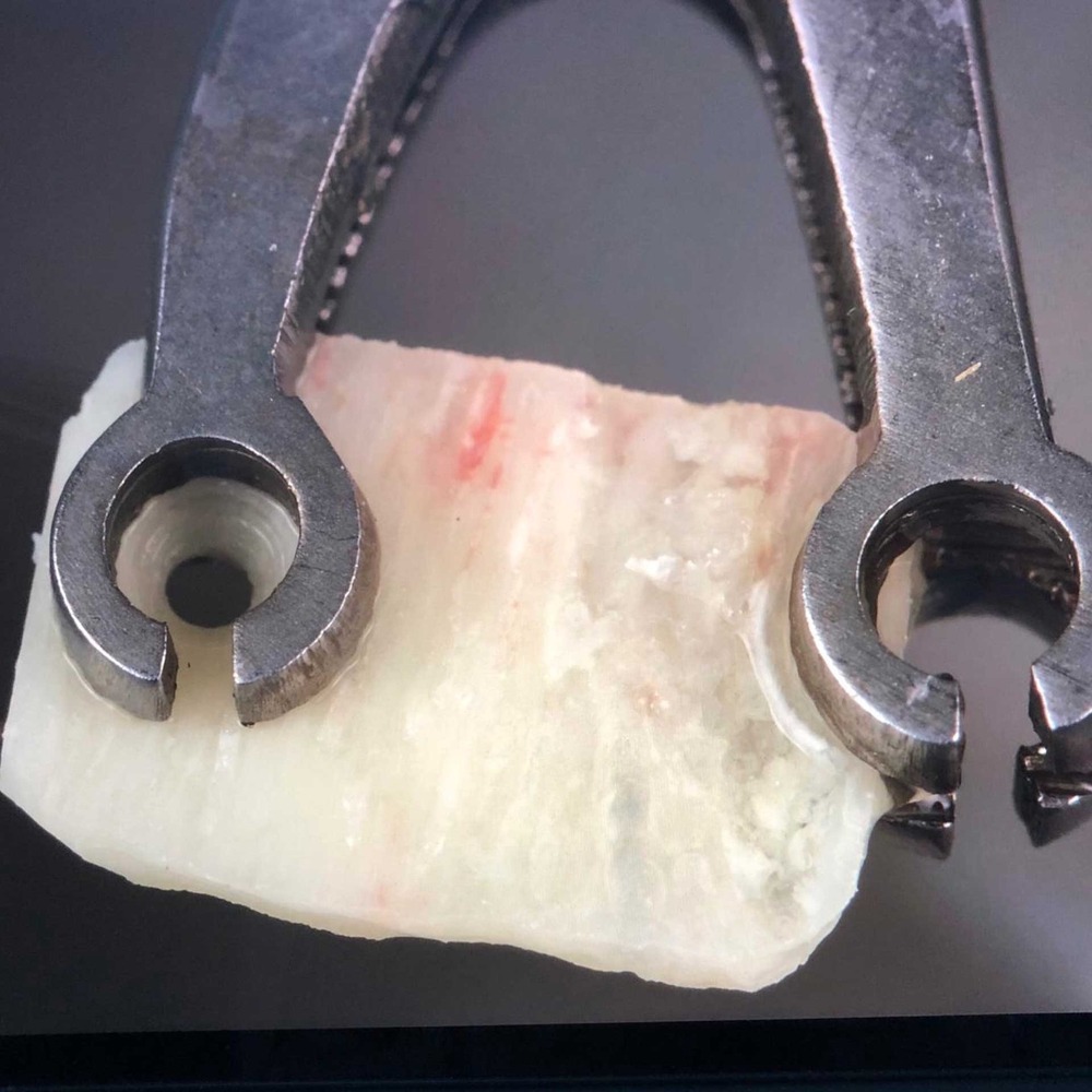 2315-60F-Naht-und-Membranpinzette-I-2-x-2-2-mm-abgewinkelt-ergonomische-Dentalinstrumente-Anwenung1