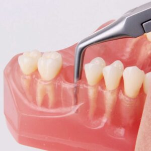 2520-65DF-Stift-und-Nervnadelzange-diamantiert-abgewinkelt-ergonomische-Dentalinstrumente-in-Kanal