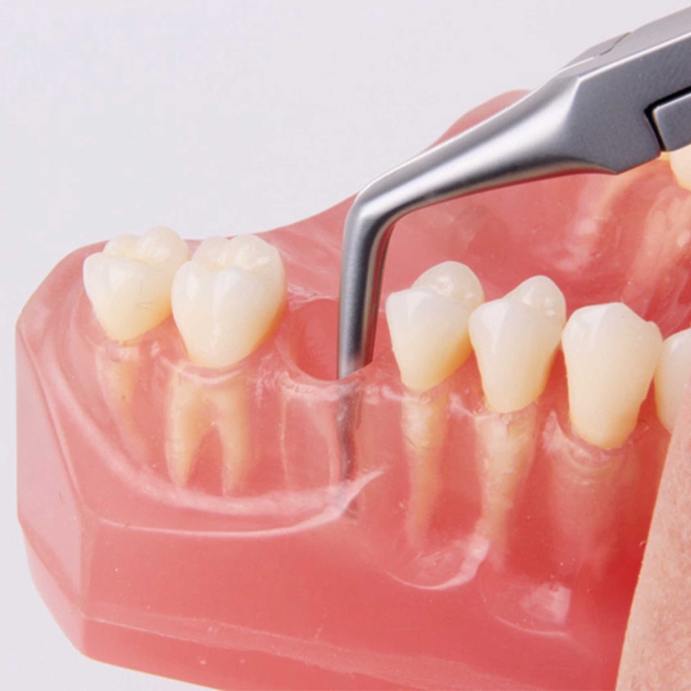 2520-65DF-Stift-und-Nervnadelzange-diamantiert-abgewinkelt-ergonomische-Dentalinstrumente-in-Kanal