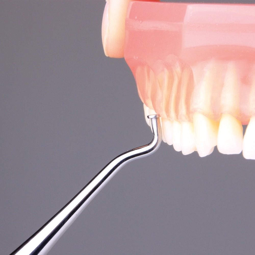 2599-10-F-Protesenentferner-Anwendung-Prinzip