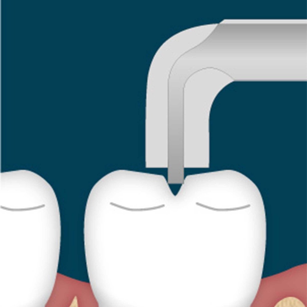 7108-00F-Kronenaufbieger-Dr-Mazouch-UNIVERSAL-PH-ergonomische-Dentalinstrumente-Frauen-CAD