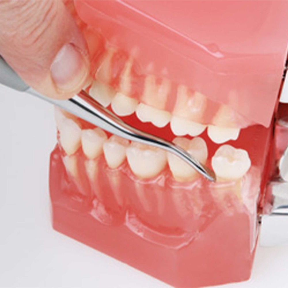 740-10F-Wurzelheber-Apical-Dritte-Molaren-PH-ergonomische-Dentalinstrumente-fuer-Frauen-Anwendung