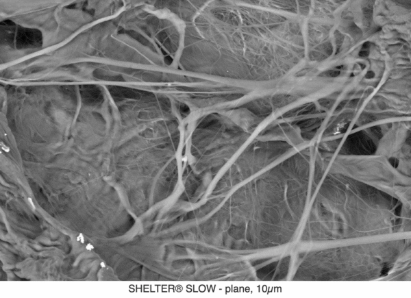 Perikardmembraan-Biometric-3