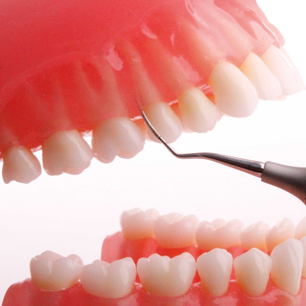 ZFMMD1F-Zahnreiniger-Feile-MD1-Mesial-Distal-diamantiert-D-54-leicht-ergonomische-Anwendung